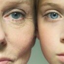 SKIN AGING