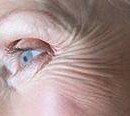 SKIN WRINKLES