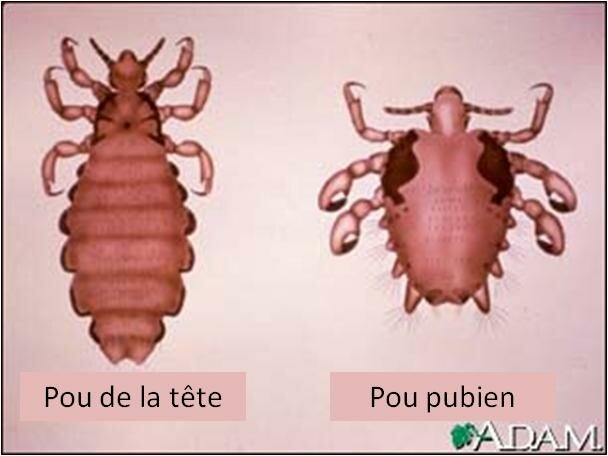 POUX PUBIENS