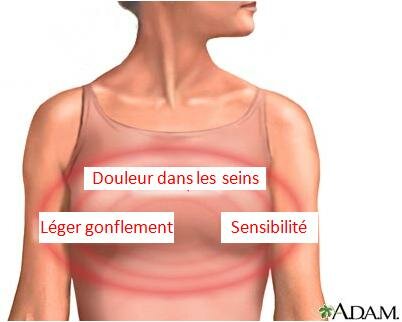 SEINS DOULOUREUX 