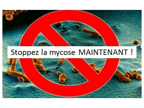 La PILULE et les MYCOSES