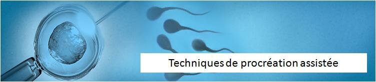 Cette opération est souvent utilisée chez les couples où il y a un sérieux problème avec le sperme. Elle est aussi parfois utilisée chez des couples âgés ou dont les tentatives de FIV ont échoué. Dans l’ICSI, un seul spermatozoïde est injecté dans un ovule mûr. Ensuite l’embryon est transféré dans l’utérus ou une trompe de Fallope.