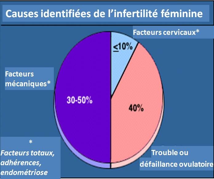 INFERTILITÉ FÉMININE