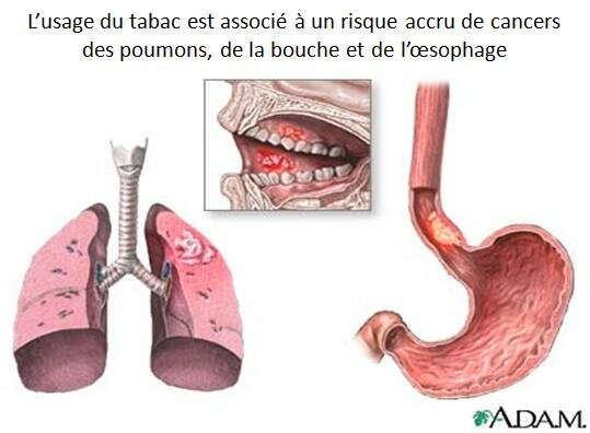 TABAGISME PASSIF