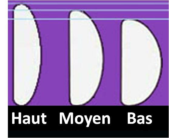 TYPES D’IMPLANTS MAMMAIRES