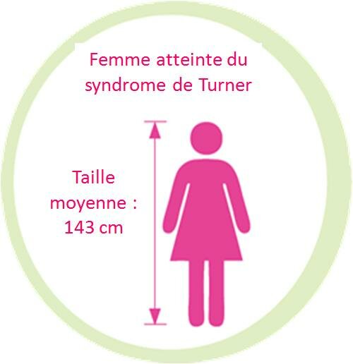 Syndrome de Turner