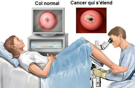 Examen pelvien