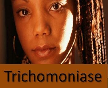 maladies sexuellement transmissibles 
