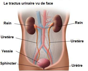 Infection du tractus urinaire