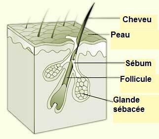 Acné