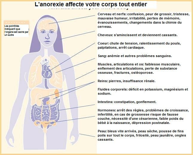 Anorexie