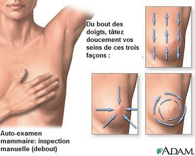 Examen mammaire