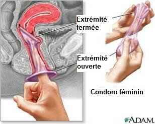 Double contraception