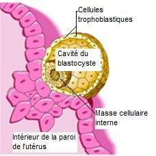 SAIGNEMENT D’IMPLANTATION