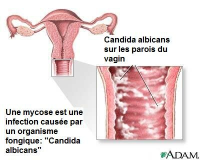 mycose