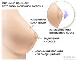 молочные железы