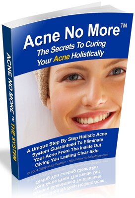 acne