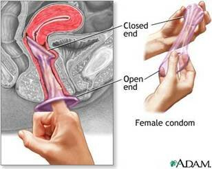 dual contraception