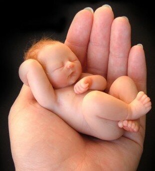 ENDOMETRIOSIS and INFERTILITY